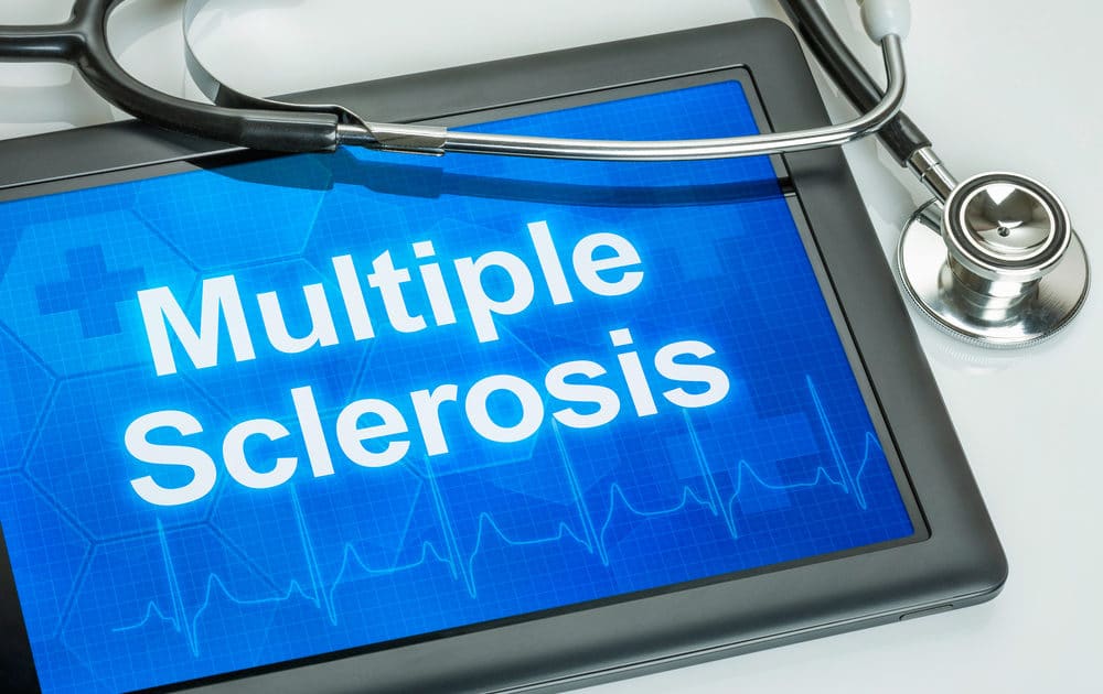 delayed onset multiple sclerosis
