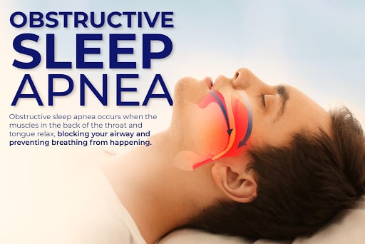 sleep apnea and hypertension
