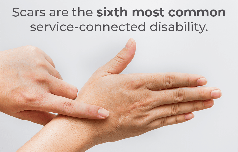 scars are the sixth most common disability