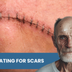 VA Rating Scars