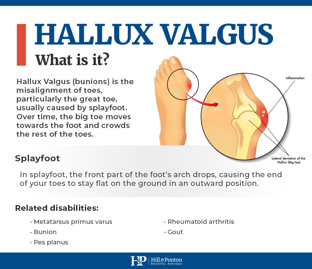 what is hallux valgus?