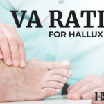 va rating for hallux valgus