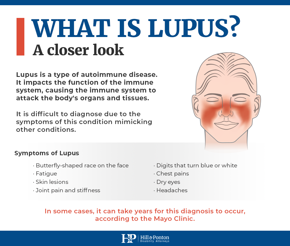 what is lupus