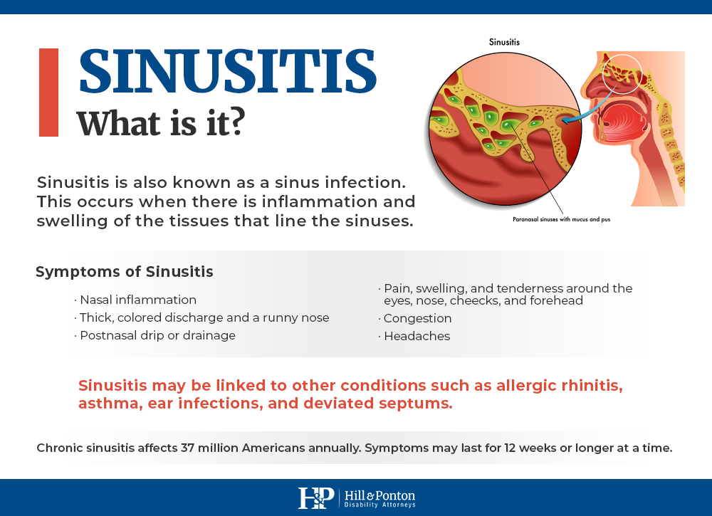 what is sinusitis