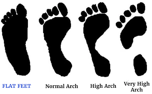 flat feet footprint
