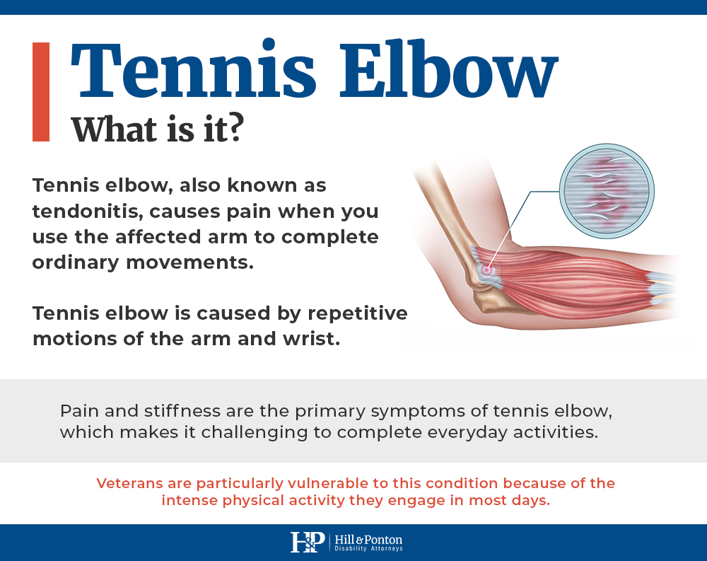 What is tennis elbow va rating