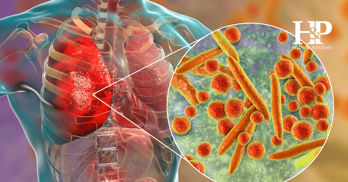 Bacterial Lung Infections