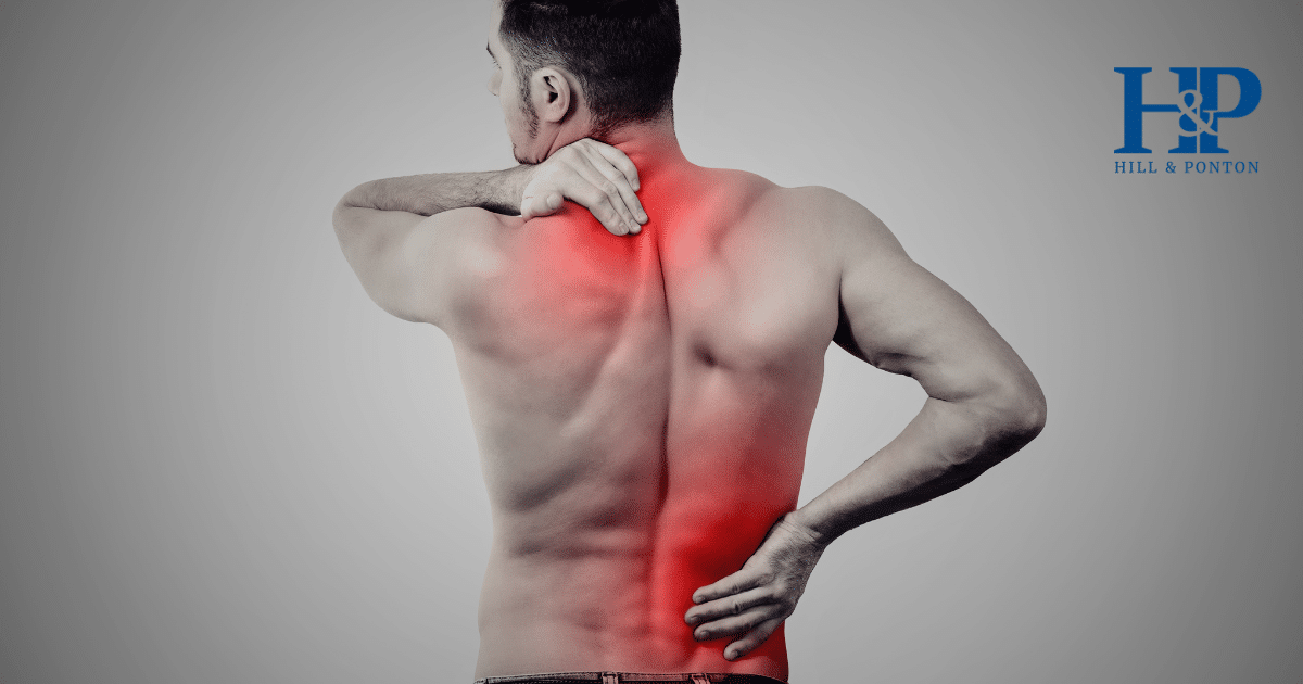 Getting a Fibromyalgia VA Rating 