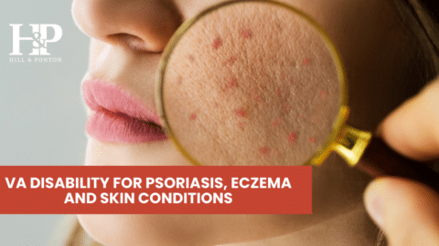 skin conditions