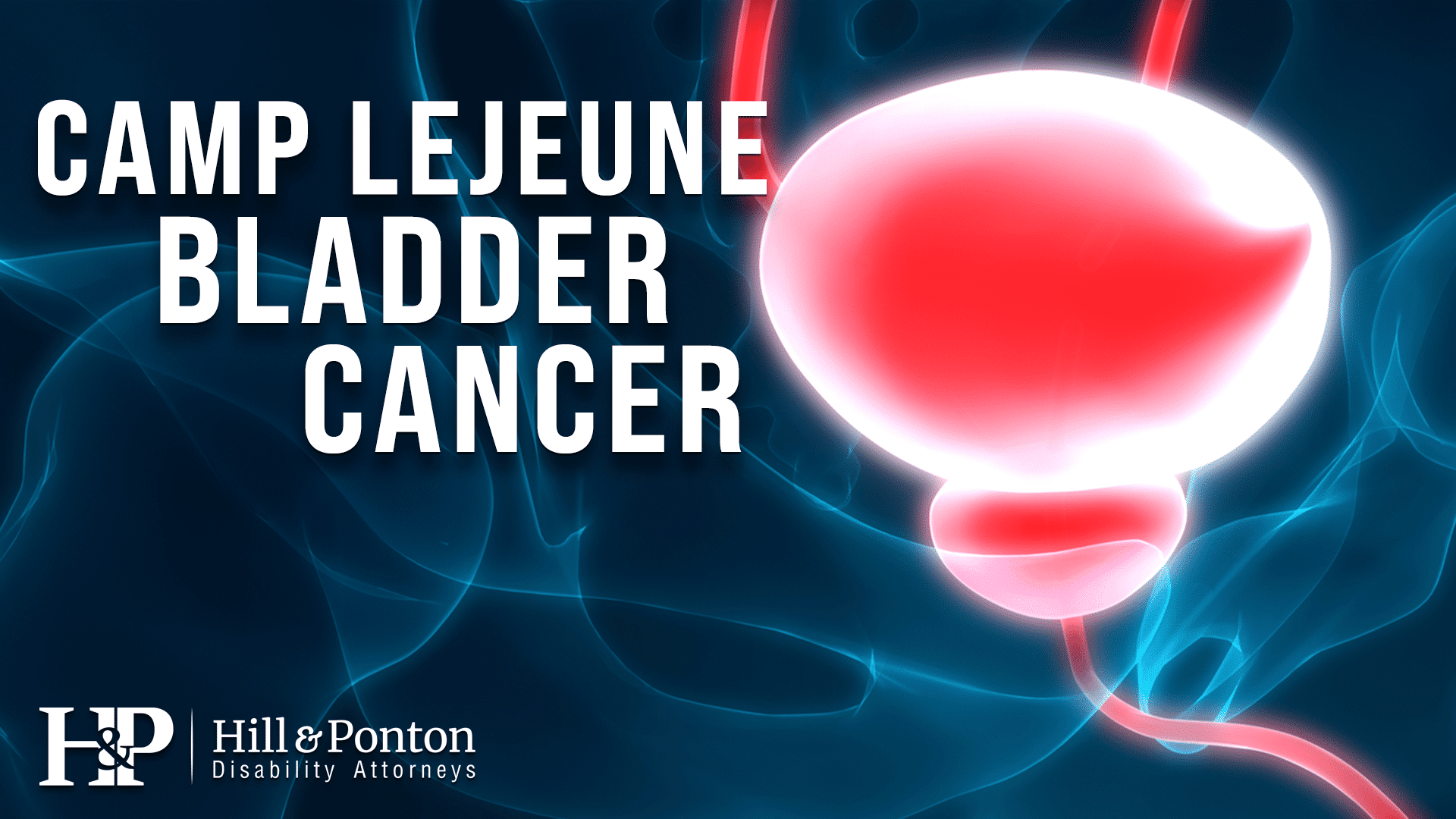 camp lejeune bladder cancer