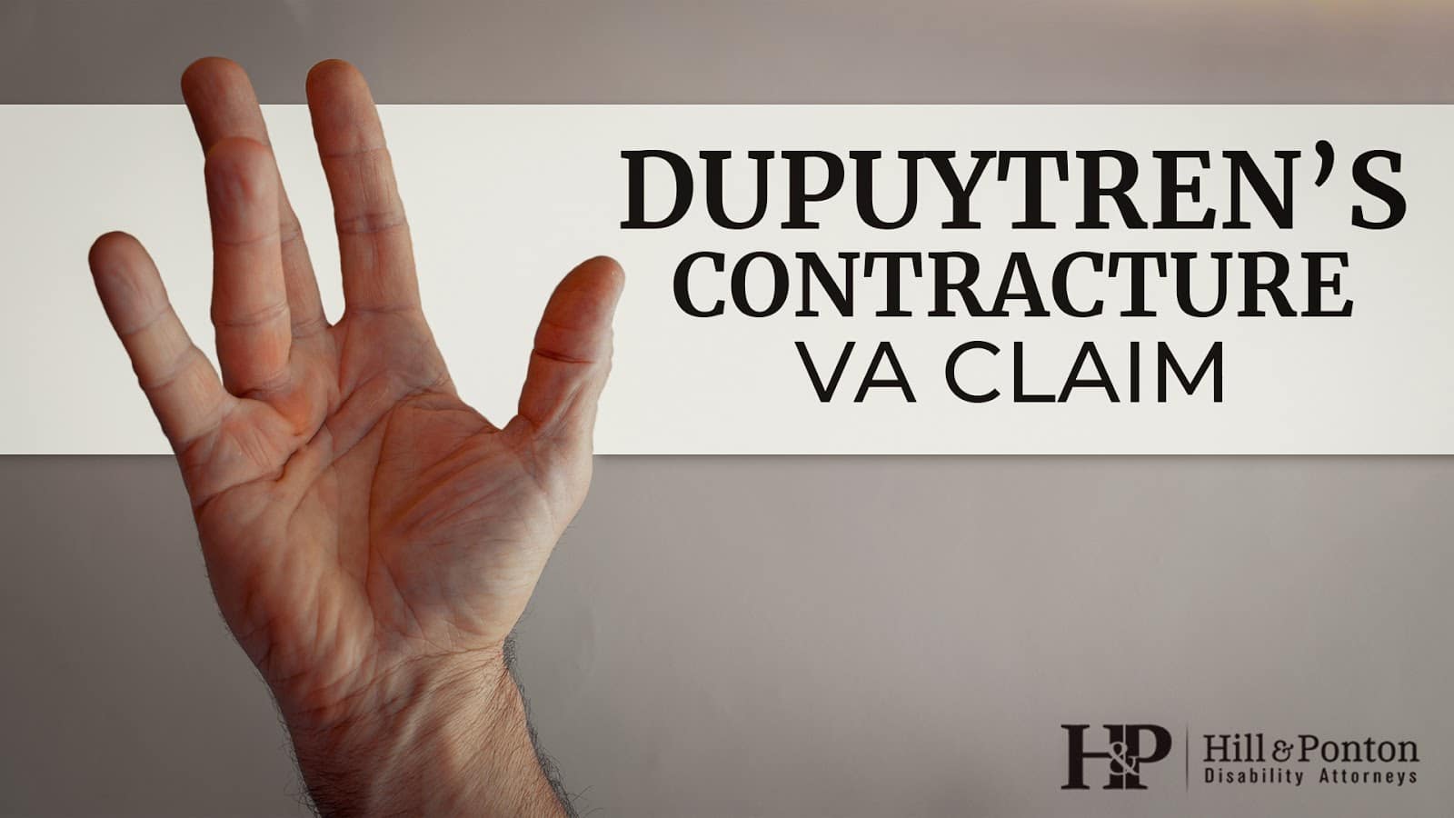 dupuytren va claim