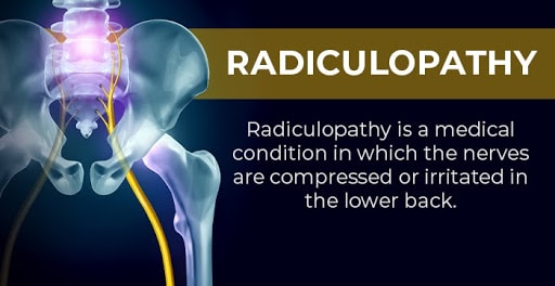 secondary conditions to back pain