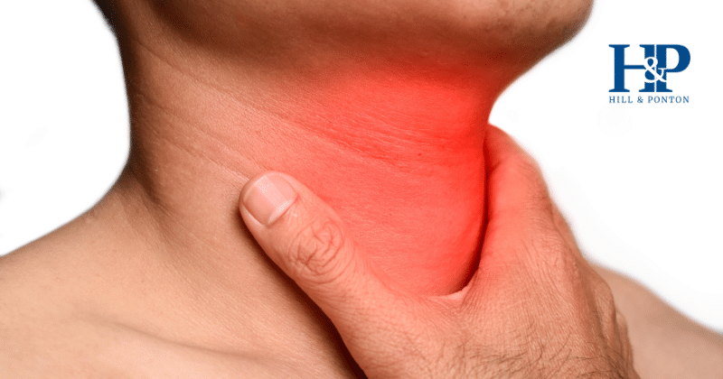Esophageal Cancer