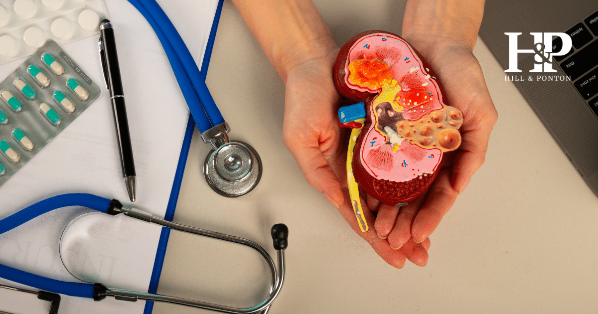 VA Disability for Chronic Kidney Disease Secondary to Hypertension