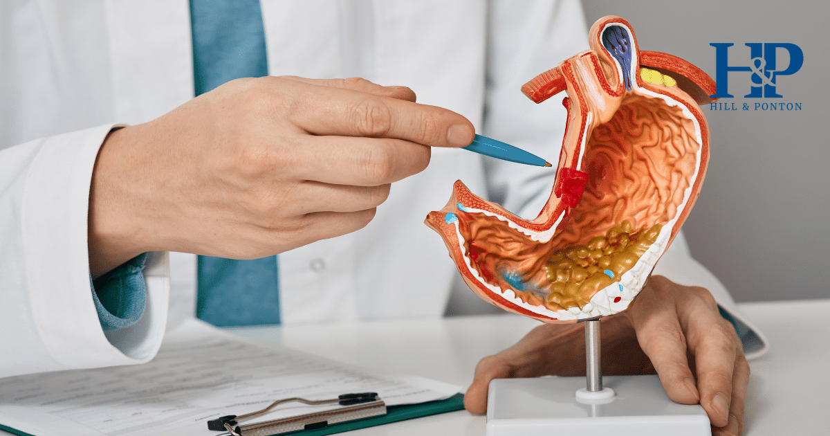 VA Secondary Conditions to IBS 