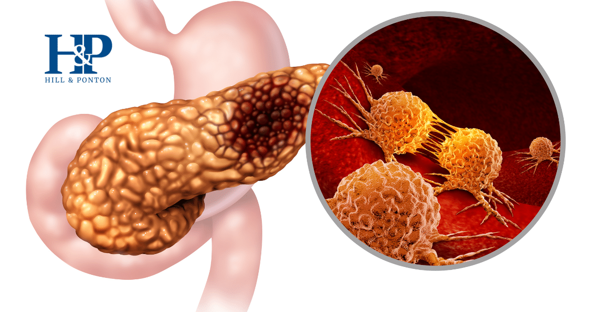 Agent Orange and Pancreatic Cancer 