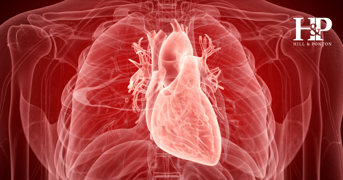 Aortic Aneurism VA Rating