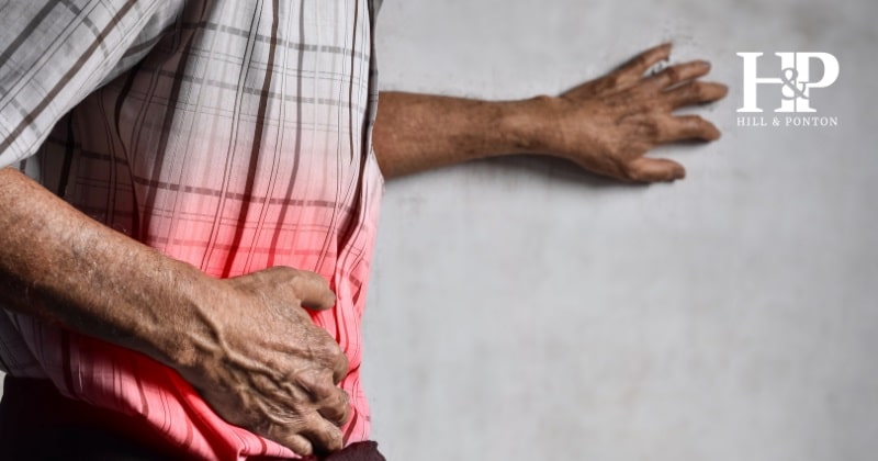 Ulcerative Colitis VA Rating
