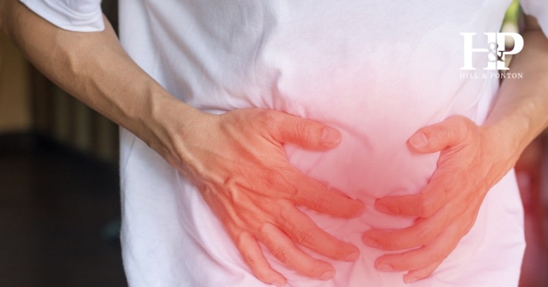 Crohn's Disease VA Rating