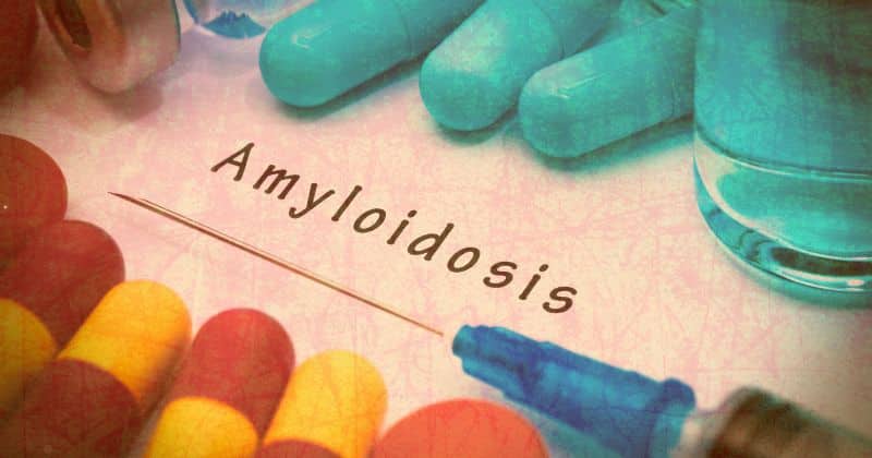 AL Amyloidosis Agent Orange