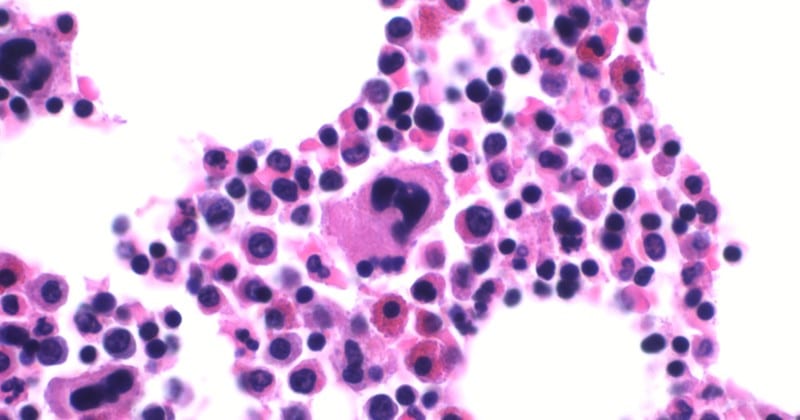 bone marrow cells